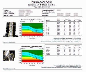 Ab welchem Alter sollte man eine Knochendichtemessung in Betracht ziehen? Ab welchem Alter sollte man eine Knochendichtemessung in Betracht ziehen?