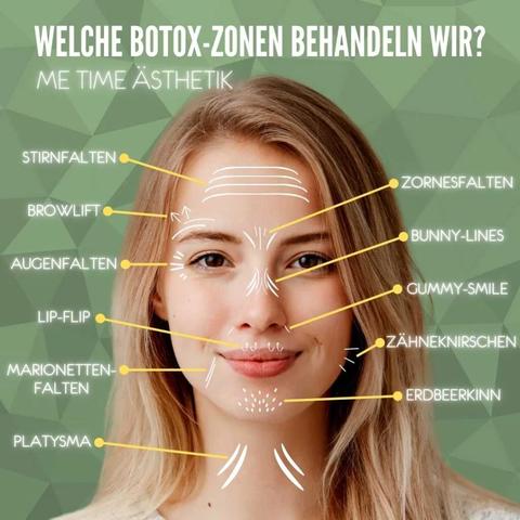 Ab wann ist die Wirkung von Botox sichtbar? Ab wann ist die Wirkung von Botox sichtbar?
