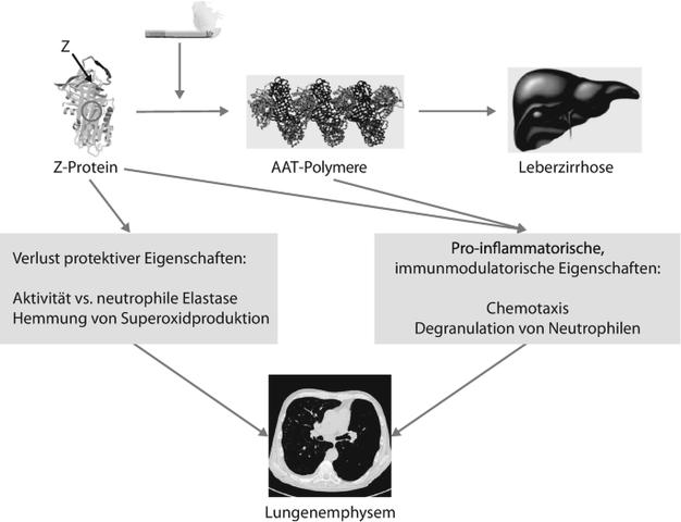 Alpha-1-Antitrypsin-Mangel: Eine seltene erbliche Form des Lungenemphysems Alpha-1-Antitrypsin-Mangel: Eine seltene erbliche Form des Lungenemphysems
