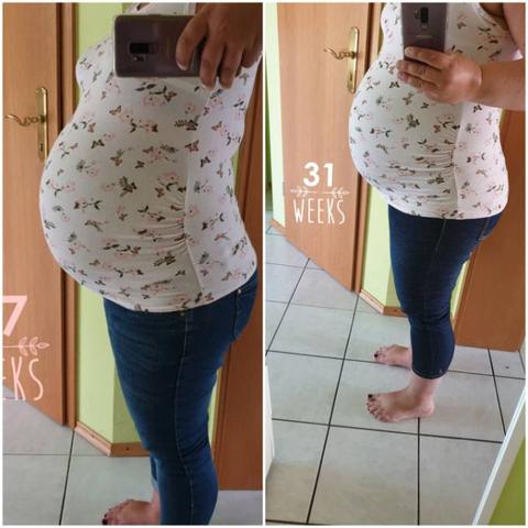 Symptome einer Senkung des Bauchs und wie man sie erkennt