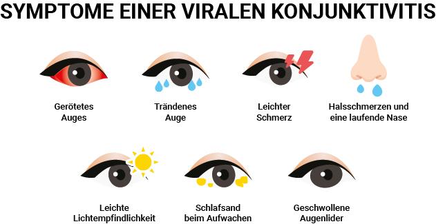 Wichtige Hinweise zur Behandlung von Bindehautentzündung bei Kindern Wichtige Hinweise zur Behandlung von Bindehautentzündung bei Kindern