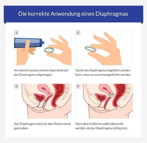 "Diaphragma: Wie funktioniert es und wie wird es angewendet?" "Diaphragma: Wie funktioniert es und wie wird es angewendet?"