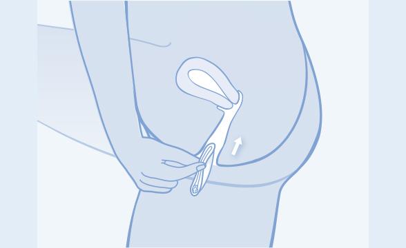 "Das Diaphragma als effektive Barrieremethode zur Verhütung" "Das Diaphragma als effektive Barrieremethode zur Verhütung"