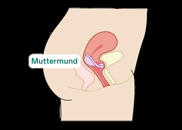 "Diaphragma: Eine Alternative zu hormonellen Verhütungsmitteln" "Diaphragma: Eine Alternative zu hormonellen Verhütungsmitteln"