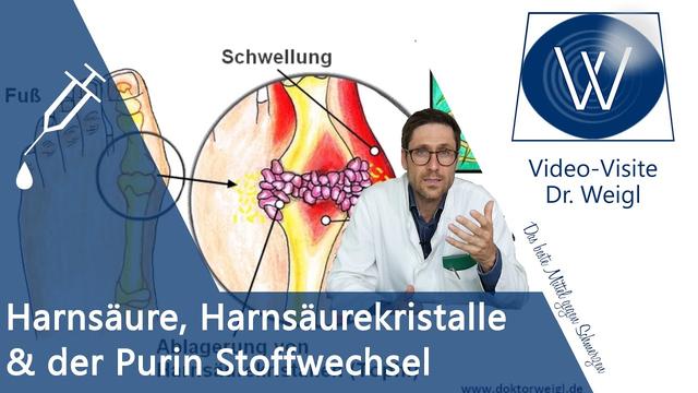 Schnelle Wege zur Reduzierung der Harnsäurewerte