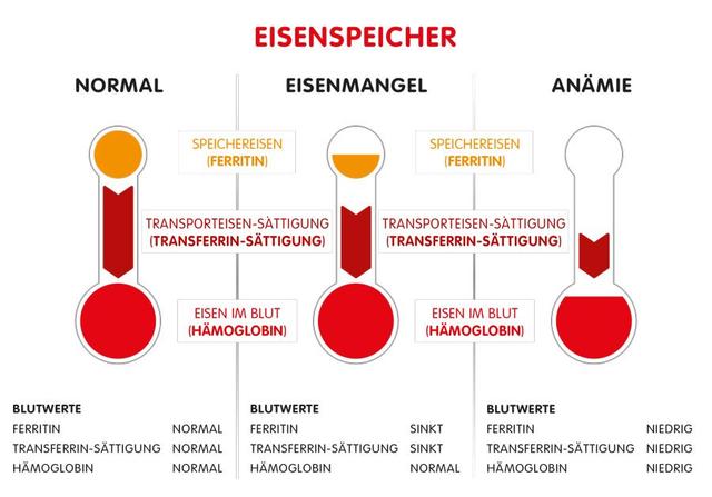 Ab wann liegt ein Mangel an Eisen vor? - Frühzeitige Erkennung durch Laboruntersuchungen Ab wann liegt ein Mangel an Eisen vor? - Frühzeitige Erkennung durch Laboruntersuchungen