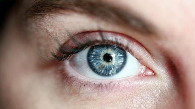 Xanthelasmen entfernen: Facharztbehandlung statt Selbstentfernung Xanthelasmen entfernen: Facharztbehandlung statt Selbstentfernung