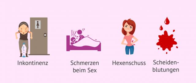 Symptome eines Gebärmuttervorfalls: Wann sollten Sie einen Arzt aufsuchen?