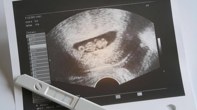 Ultraschall: Ab welcher Schwangerschaftswoche ist der Herzschlag sichtbar? Ultraschall: Ab welcher Schwangerschaftswoche ist der Herzschlag sichtbar?