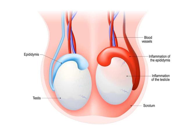 Hodentorsion selbst beheben? Warum ärztliche Hilfe unerlässlich ist Hodentorsion selbst beheben? Warum ärztliche Hilfe unerlässlich ist
