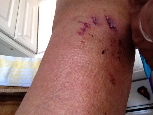 Hundebiss: Ab wann ist ein Arztbesuch notwendig?