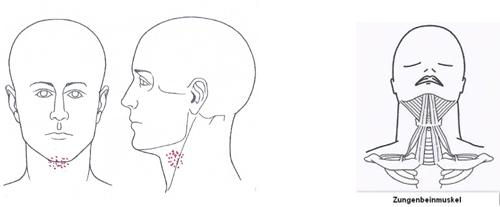 Kloß im Hals: Ursachen und Behandlungsmöglichkeiten Kloß im Hals: Ursachen und Behandlungsmöglichkeiten