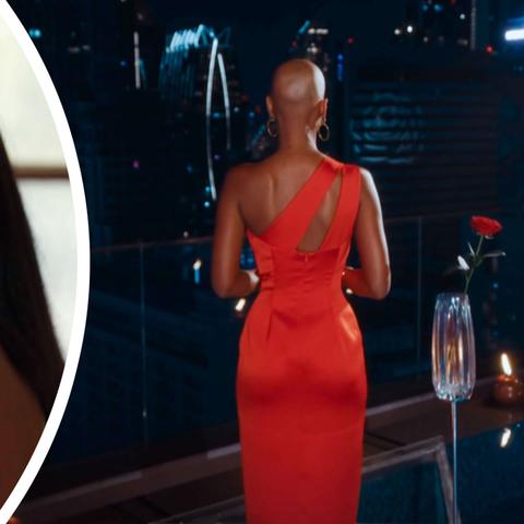 Die Wahrheit über die Glatze der Bachelorette: Kreisrunder Haarausfall Die Wahrheit über die Glatze der Bachelorette: Kreisrunder Haarausfall