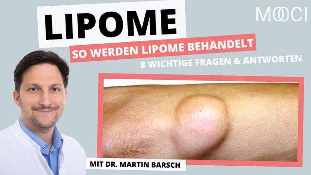 Erfahrungen mit der selbstständigen Entfernung von Lipomen: Was gibt es zu beachten? Erfahrungen mit der selbstständigen Entfernung von Lipomen: Was gibt es zu beachten?