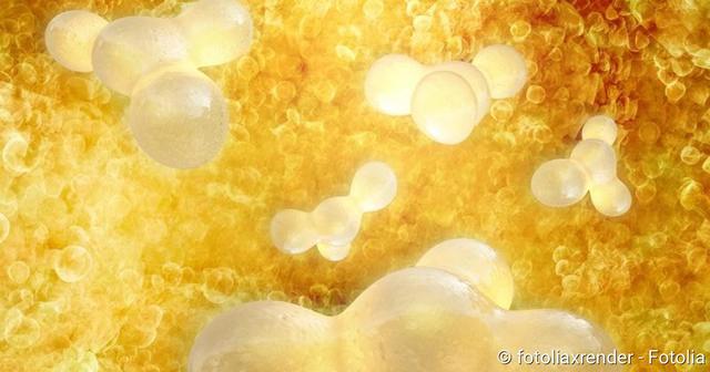 Was ist ein Lipom? Ursachen, Symptome und Behandlung erklärt