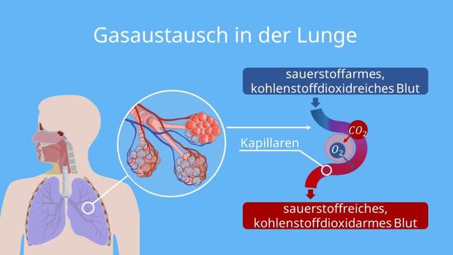 Was ist ein Lungenemphysem und wie wirkt es sich auf die Atmung aus? Was ist ein Lungenemphysem und wie wirkt es sich auf die Atmung aus?