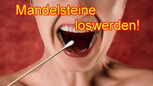 Selbsthilfe bei Mandelsteinen: Hausmittel und Tipps Selbsthilfe bei Mandelsteinen: Hausmittel und Tipps