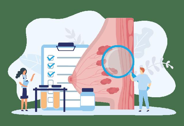 4. Früherkennung von bösartigen Mikroverkalkungen in der Brust: Was Sie wissen sollten