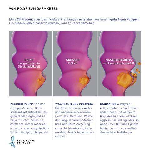 5. Wie können Sie Ihr individuelles Darmkrebs-Risiko reduzieren? 5. Wie können Sie Ihr individuelles Darmkrebs-Risiko reduzieren?