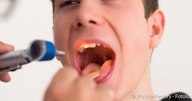 Rachenentzündung: Diagnose und mögliche Komplikationen Rachenentzündung: Diagnose und mögliche Komplikationen
