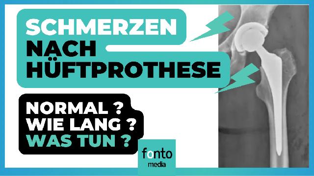 Schmerzen im Oberschenkel nach HüftOP Ursachen und Behandlung Sieu