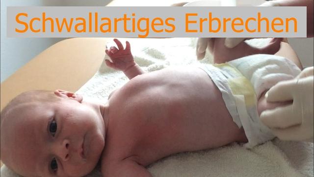 Verdickter Pförtnermuskel bei Babys: Wann sollten Eltern einen Arzt aufsuchen? Verdickter Pförtnermuskel bei Babys: Wann sollten Eltern einen Arzt aufsuchen?