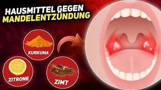 Natürliche Mittel bei Mandelentzündung: Linderung und Unterstützung der Therapie