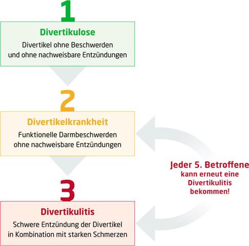 Was ist Sigmadivertikulitis? Ursachen, Verlauf und Therapiemöglichkeiten erklärt Was ist Sigmadivertikulitis? Ursachen, Verlauf und Therapiemöglichkeiten erklärt