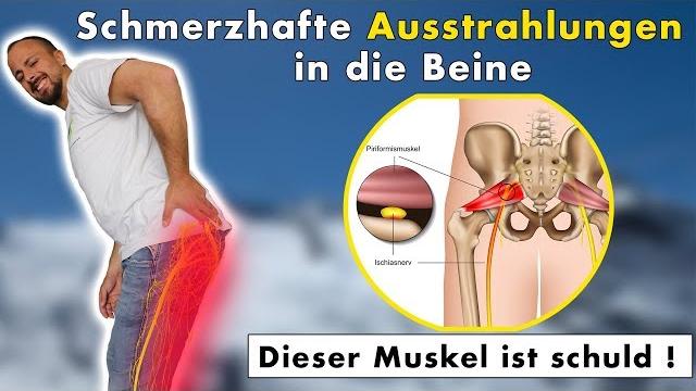 Wann sollte man nach einem Sturz auf das Steißbein zum Arzt gehen? Wann sollte man nach einem Sturz auf das Steißbein zum Arzt gehen?