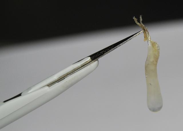 Popel: Eine Mischung aus Wasser, Schmutz und Proteinen Popel: Eine Mischung aus Wasser, Schmutz und Proteinen