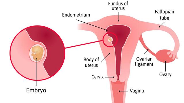 Symptome der Einnistung: Symptome der Einnistung: