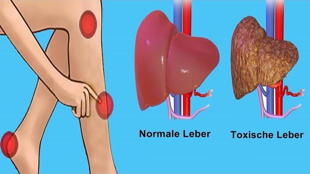 Ab welchem Wert sind erhöhte Gamma-GT-Werte gefährlich? Ab welchem Wert sind erhöhte Gamma-GT-Werte gefährlich?