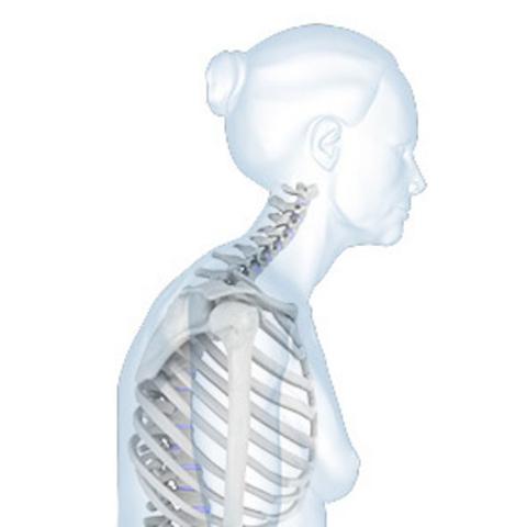 Gefahrenzone Osteoporose: Wann wird der Knochenschwund gefährlich?