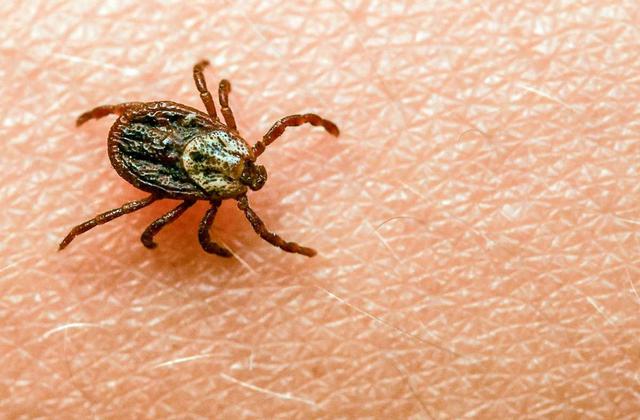 Ab wann sollte man nach einem Zeckenbiss einen Arzt konsultieren? Ab wann sollte man nach einem Zeckenbiss einen Arzt konsultieren?