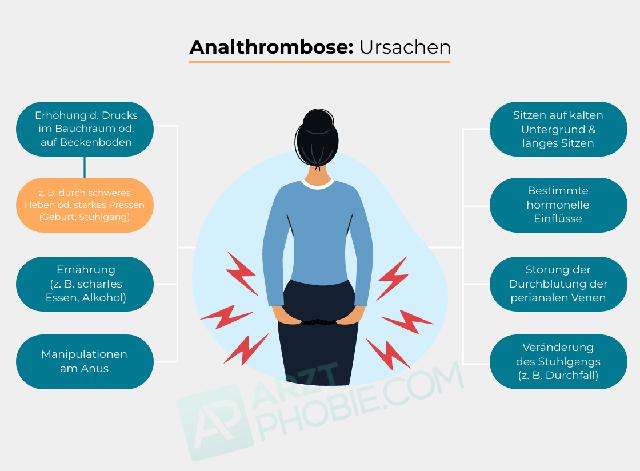 Warum Bettruhe bei Analthrombose empfohlen wird: Effektive Maßnahme zur Schmerzlinderung und Heilungsunterstützung Warum Bettruhe bei Analthrombose empfohlen wird: Effektive Maßnahme zur Schmerzlinderung und Heilungsunterstützung