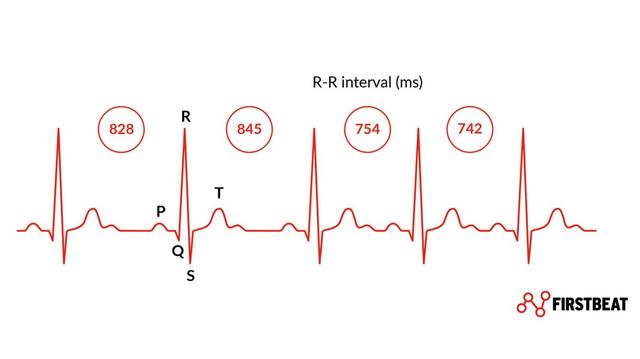 BPM und Gesundheit: Warum die Herzfrequenz wichtig ist BPM und Gesundheit: Warum die Herzfrequenz wichtig ist