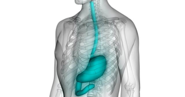 Vermeiden Sie diese Nahrungsmittel bei einer Speiseröhrenentzündung. Vermeiden Sie diese Nahrungsmittel bei einer Speiseröhrenentzündung.