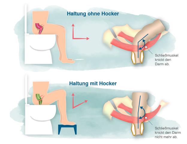 Verstopfung bekämpfen: Tipps und Tricks für einen regelmäßigen Stuhlgang Verstopfung bekämpfen: Tipps und Tricks für einen regelmäßigen Stuhlgang