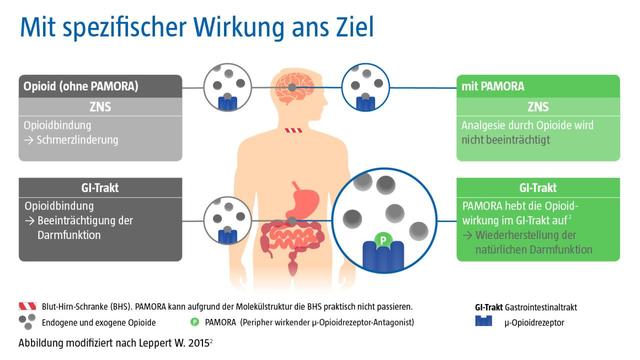 Behandlungsmöglichkeiten bei einer Atemdepression