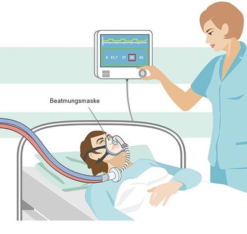 Intubation: Risiken und Komplikationen Intubation: Risiken und Komplikationen