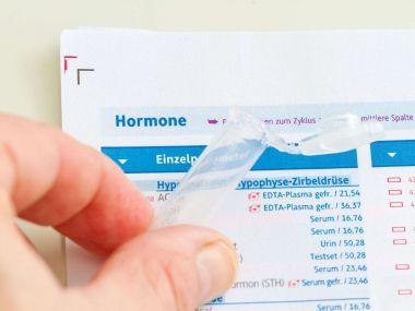 Der Leading Medicine Guide: Qualitätskriterien für Endokrinologen