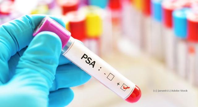 Was Sie wissen sollten, bevor Sie einen PSA-Test machen Was Sie wissen sollten, bevor Sie einen PSA-Test machen