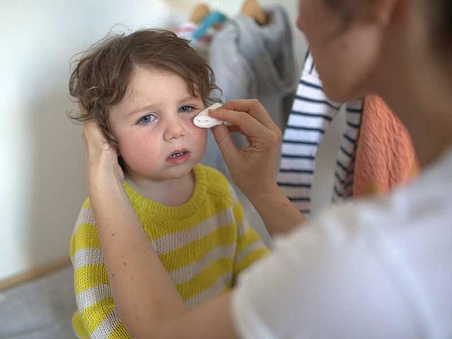 Wie man eine Bindehautentzündung bei Kindern behandelt: Praktische Ratschläge Wie man eine Bindehautentzündung bei Kindern behandelt: Praktische Ratschläge