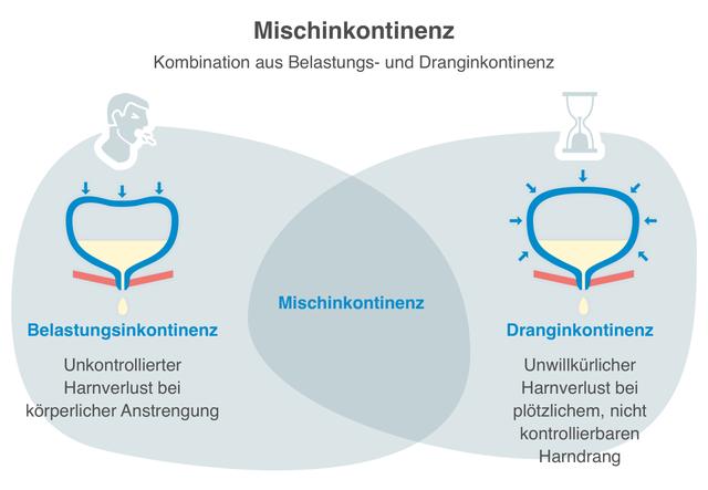 Blasenschwäche bei Frauen: Ursachen, Diagnose und effektive Maßnahmen zur Verbesserung der Lebensqualität Blasenschwäche bei Frauen: Ursachen, Diagnose und effektive Maßnahmen zur Verbesserung der Lebensqualität