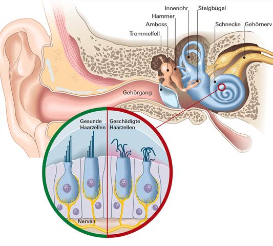 Einseitiger Tinnitus: Strategien zur Bewältigung von Rauschen im Ohr Einseitiger Tinnitus: Strategien zur Bewältigung von Rauschen im Ohr