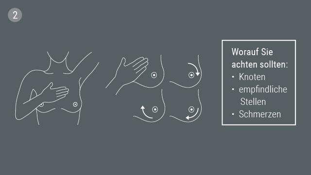 Warnsignale für Brustkrebs: Wie fühlt sich ein maligner Knoten an? Warnsignale für Brustkrebs: Wie fühlt sich ein maligner Knoten an?