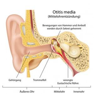 Wie lange hält das dumpfe Gefühl im Ohr nach einer Otitis media an?