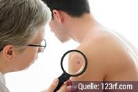 Empfohlene Häufigkeit für das Hautscreening