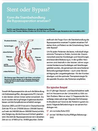Risiken und Komplikationen bei der Verwendung von Stents am Herzen Risiken und Komplikationen bei der Verwendung von Stents am Herzen