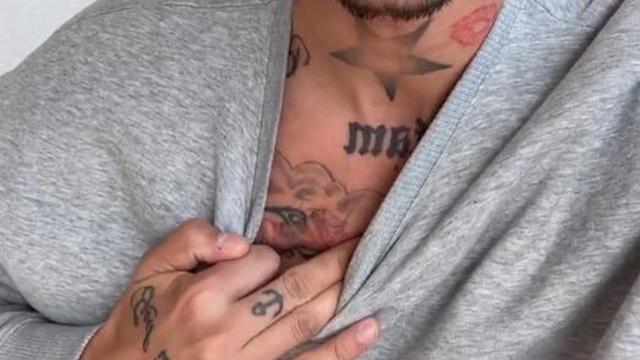 Die Wahrheit über Yasin Mohameds auffällige Narbe auf der Brust